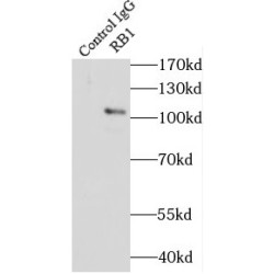 Retinoblastoma Protein 1 (RB1) Antibody