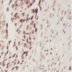 RB1 Inducible Coiled-Coil 1 (RB1CC1) Antibody