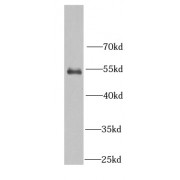 WB analysis of A431 cells, using RBBP7 antibody (1/1000 dilution).