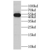 WB analysis of Jurkat cells, using RBBP4 antibody (1/500 dilution).