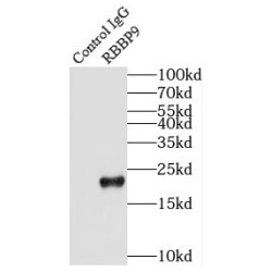 Histone-Binding Protein RBBP9 (RBBP9) Antibody