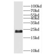 WB analysis of mouse testis tissue, using RBBP9 antibody (1/400 dilution).
