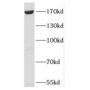 WB analysis of HT-1080 cells, using RBM16 antibody (1/2000 dilution).