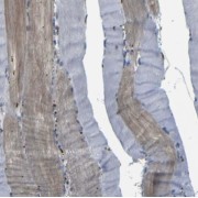 IHC-P analysis of human skeletal muscle tissue, using RBM24 antibody (1/50 dilution).