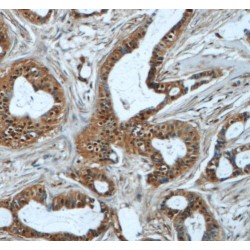 RNA Binding Motif Protein 25 (RBM25) Antibody
