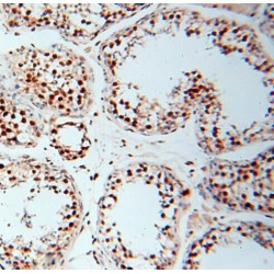 Putative RNA-Binding Protein 3 (RBM3) Antibody