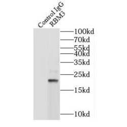 Putative RNA-Binding Protein 3 (RBM3) Antibody