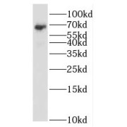WB analysis of A549 cells, using RBM47 antibody (1/1000 dilution).
