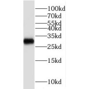WB analysis of HepG2 cells, using RBMX2 antibody (1/500 dilution).