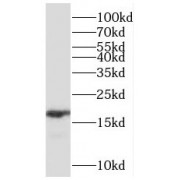 WB analysis of HEK-293 cells, using RBP1 antibody (1/1000 dilution).