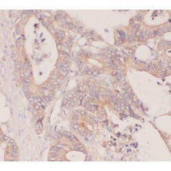 Retinoid-Binding Protein 7 (RBP7) Antibody