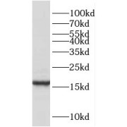 WB analysis of HEK-293 cells, using RBP7 antibody (1/1000 dilution).