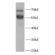WB analysis of mouse kidney tissue, using RBPJ antibody (1/1000 dilution).