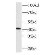 WB analysis of A431 cells, using RCL1 antibody (1/1000 dilution).