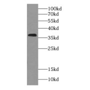 WB analysis of human heart tissue, using RDH14 antibody (1/200 dilution).