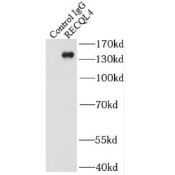 RecQ Like Helicase 4 (RECQL4) Antibody