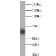 WB analysis of mouse testis tissue, using RECQL5 antibody (1/1000 dilution).