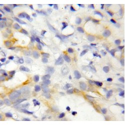 Receptor Accessory Protein 6 (REEP6) Antibody