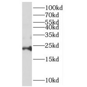 WB analysis of BxPC-3 cells, using REEP6 antibody (1/400 dilution).