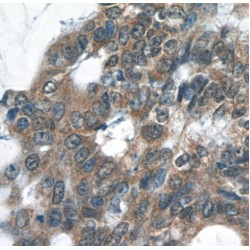 V-Rel Reticuloendotheliosis Viral Oncogene Homolog B (RELB) Antibody