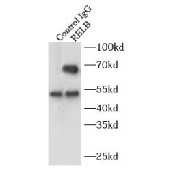 V-Rel Reticuloendotheliosis Viral Oncogene Homolog B (RELB) Antibody