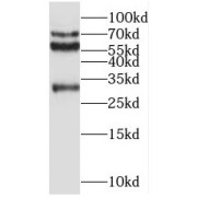 WB analysis of mouse brain tissue, using REPS2 antibody (1/300 dilution).