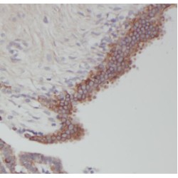 RAS Like Estrogen Regulated Growth Inhibitor (RERG) Antibody