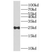 WB analysis of MCF7 cells, using RERG antibody (1/1000 dilution).