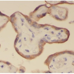 RNA Exonuclease 2 (REXO2) Antibody