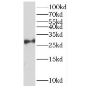 WB analysis of mouse liver tissue, using REX2 antibody (1/300 dilution).