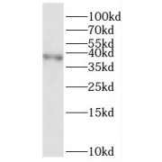WB analysis of human liver tissue, using RFC3 antibody (1/500 dilution).