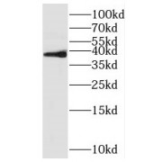 WB analysis of mouse testis tissue, using RFFL antibody (1/500 dilution).