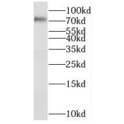 WB analysis of HeLa cells, using RFX3 antibody (1/1000 dilution).