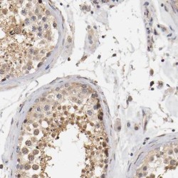 Regulator of G Protein Signaling 17 (RGS17) Antibody