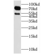 WB analysis of mouse brain tissue, using RGS9 antibody (1/500 dilution).