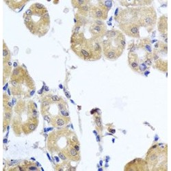 Rho-Related GTP-Binding Protein RhoB (RHOB) Antibody