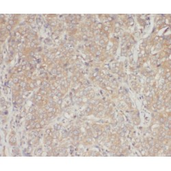 RhoGDI Antibody