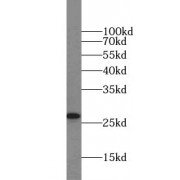 WB analysis of Jurkat cells, using ARHGDIA, aGDI antibody (1/1000 dilution).