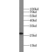 WB analysis of Jurkat cells, using ARHGDIA, aGDI antibody (1/1000 dilution).