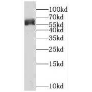 WB analysis of human brain tissue, using RIC8A antibody (1/200 dilution).