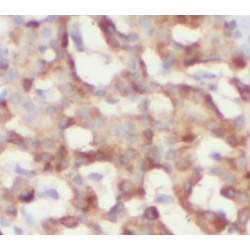 RIP3 Antibody