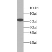 WB analysis of Jurkat cells, using RIP3 antibody (1/500 dilution).
