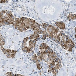 Raf Kinase Inhibitor Protein (RKIP) Antibody