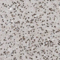 RecQ-Mediated Genome Instability Protein 1 (RMI1) Antibody