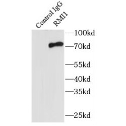 RecQ-Mediated Genome Instability Protein 1 (RMI1) Antibody