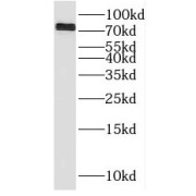 WB analysis of HepG2 cells, using RMI1 antibody (1/500 dilution).