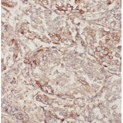 E3 Ubiquitin-Protein Ligase MGRN1 (MGRN1) Antibody