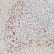 IHC-P analysis of human spleen tissue, using RNF213 antibody (1/50 dilution).