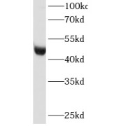 WB analysis of HeLa cells, using RNH1 antibody (1/2000 dilution).