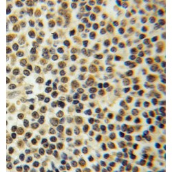 Polypyrimidine Tract-Binding Protein 3 (PTBP3) Antibody